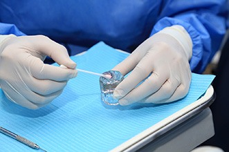 Dentist preparing to place dental sealants over back teeth