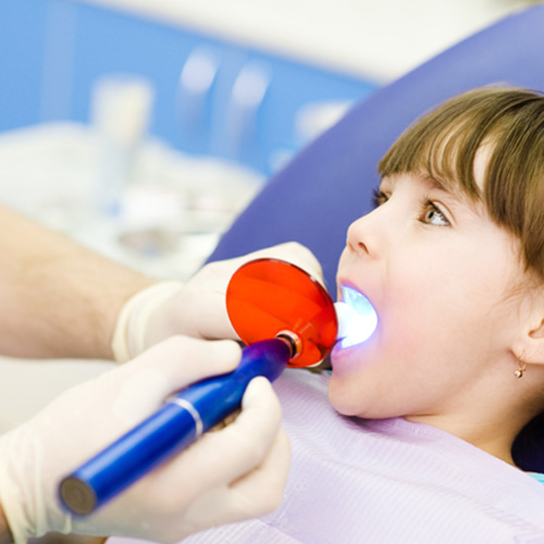 Little girl receiving a tooth-colored filling